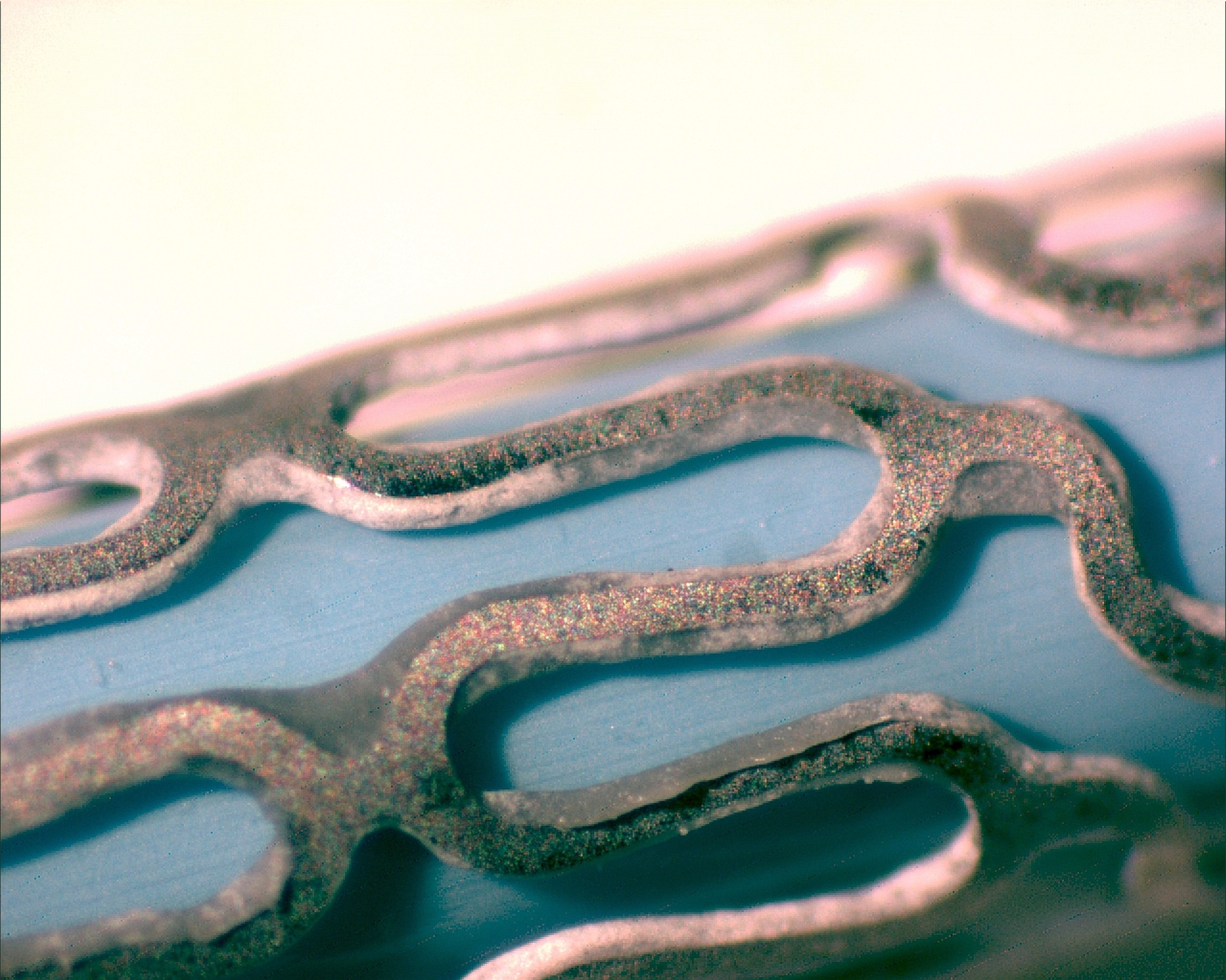Stent